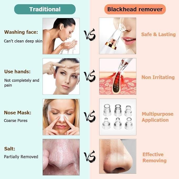 Multi-Function Blackhead Remover